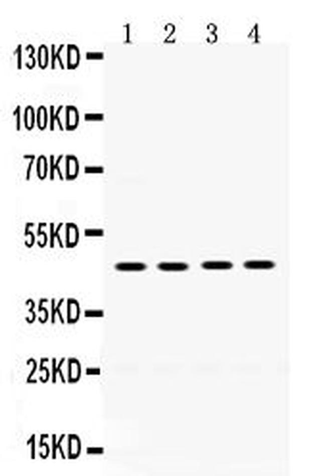 PAR1 Antibody in Western Blot (WB)