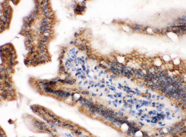 H-Ras Antibody in Immunohistochemistry (Paraffin) (IHC (P))