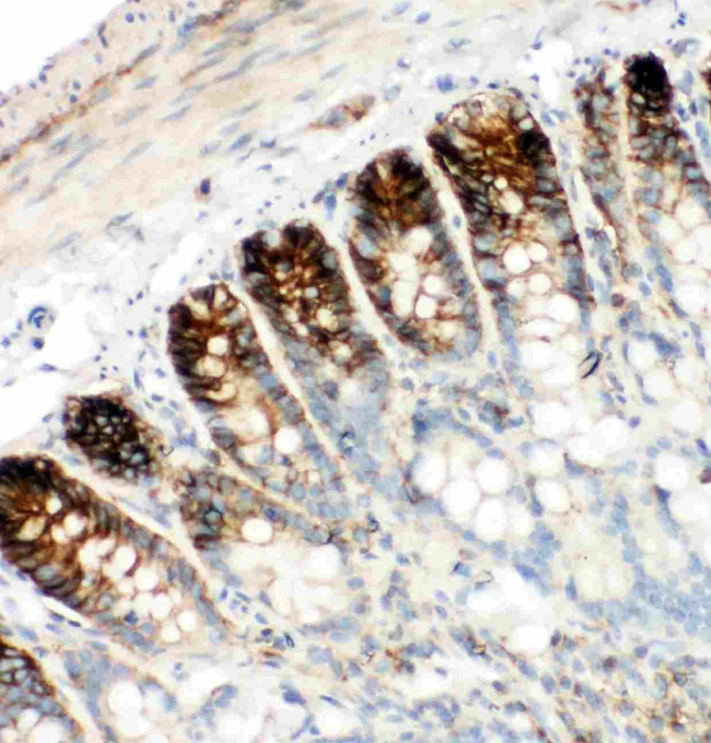 CD44 Antibody in Immunohistochemistry (Paraffin) (IHC (P))