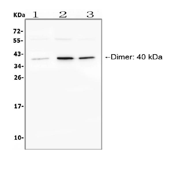 CD268 (BAFF Receptor) Antibody in Western Blot (WB)