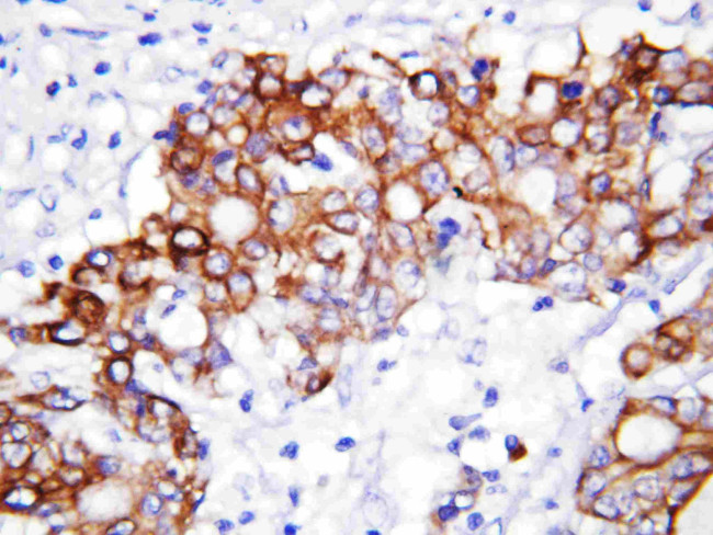 GCLC Antibody in Immunohistochemistry (Paraffin) (IHC (P))