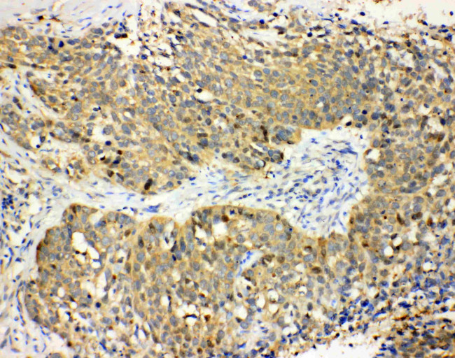 Haptoglobin Antibody in Immunohistochemistry (Paraffin) (IHC (P))