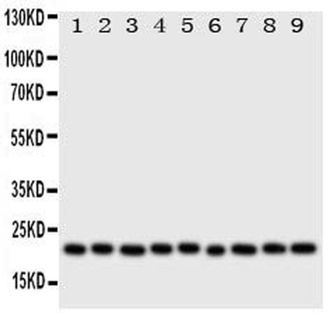 Cytoglobin Antibody in Western Blot (WB)