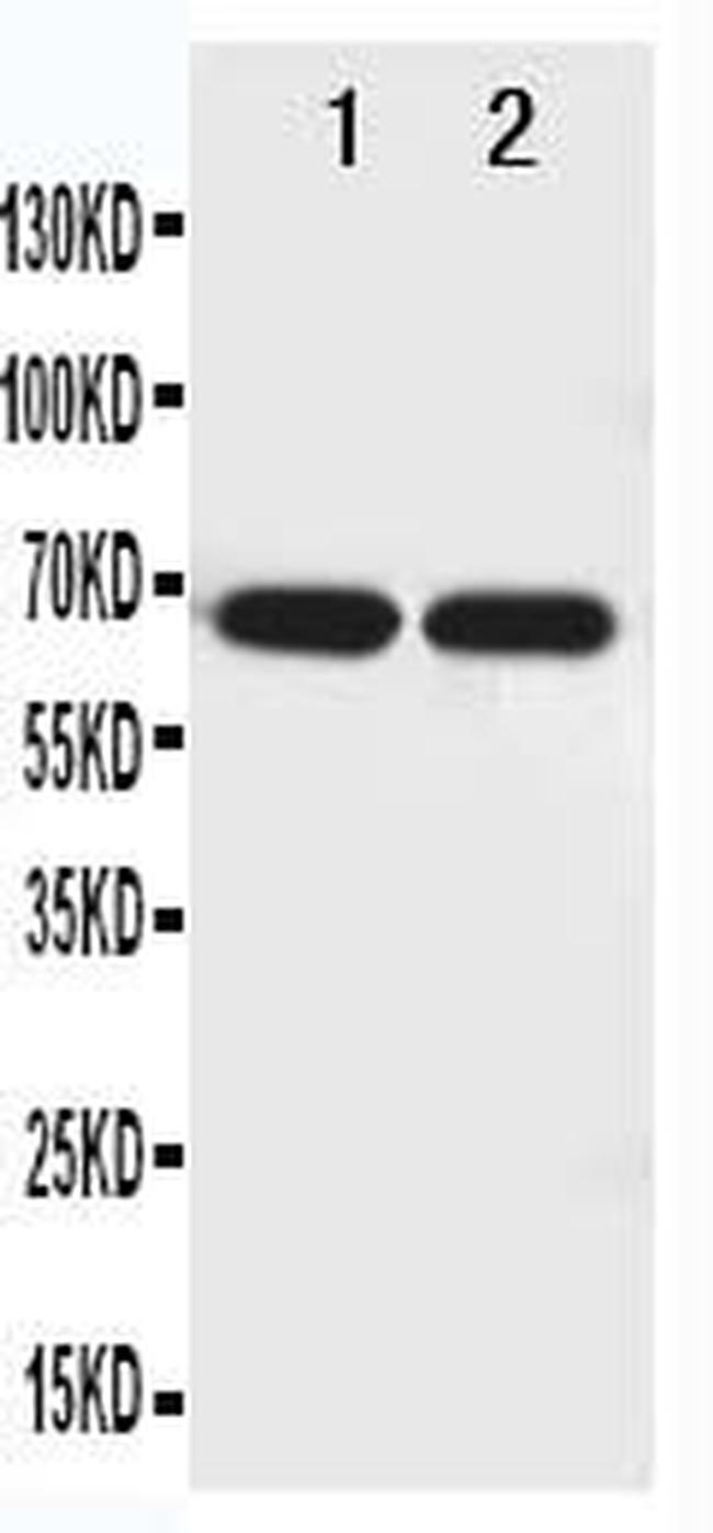 NTN1 Antibody in Western Blot (WB)
