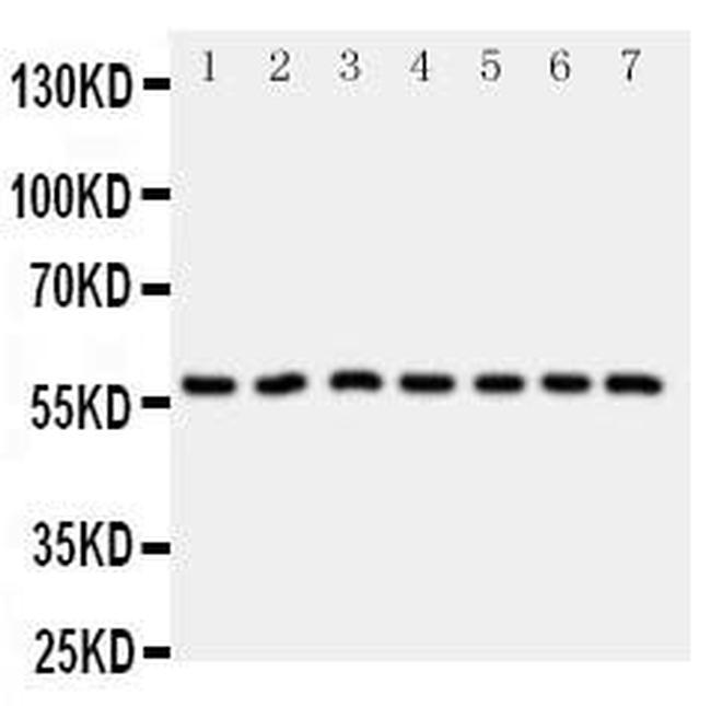 CYP11B1 Antibody in Western Blot (WB)