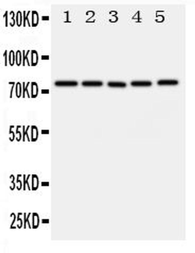 ABCG1 Antibody in Western Blot (WB)