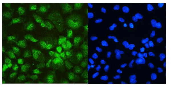 DDX5 Antibody in Immunocytochemistry (ICC/IF)