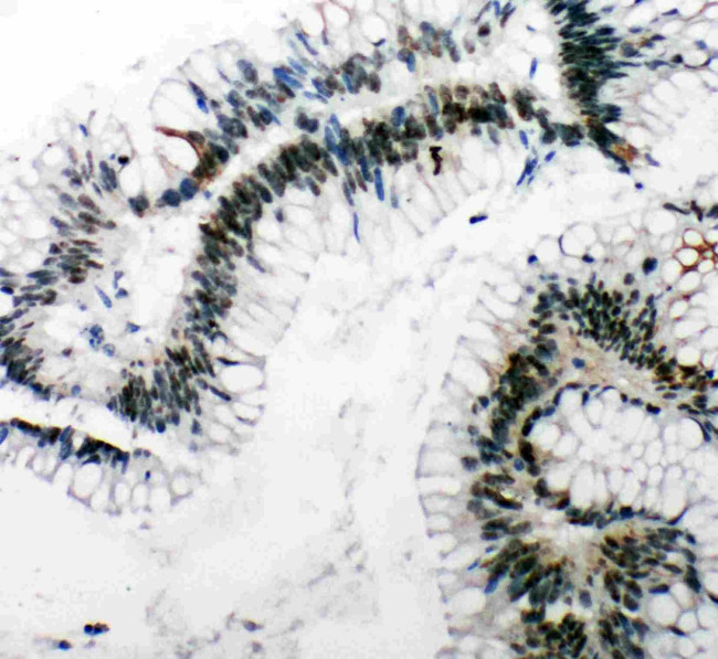 53BP1 Antibody in Immunohistochemistry (Paraffin) (IHC (P))