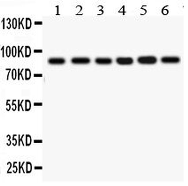 IKK beta Antibody in Western Blot (WB)