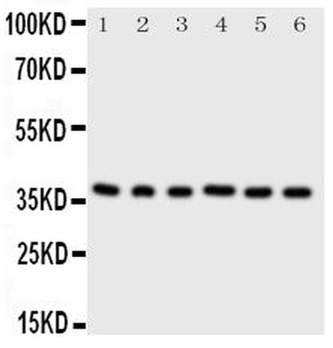 CDK7 Antibody in Western Blot (WB)
