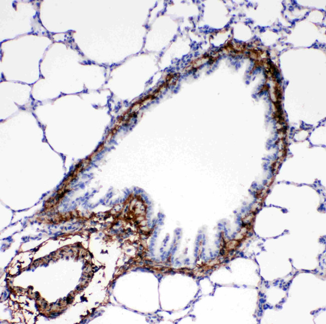 Collagen I Antibody in Immunohistochemistry (Paraffin) (IHC (P))