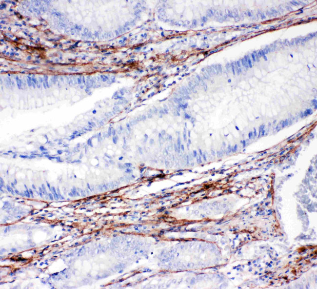 Collagen I Antibody in Immunohistochemistry (Paraffin) (IHC (P))