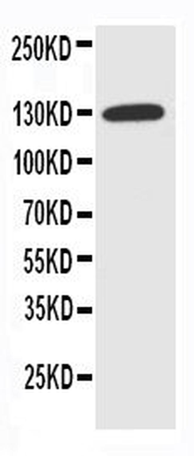 NKCC1 Antibody in Western Blot (WB)