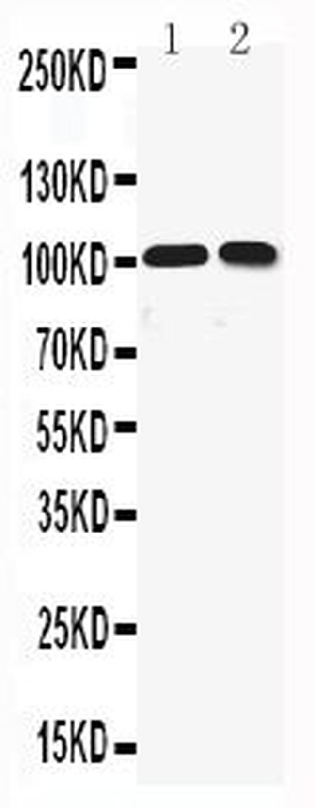 KCNQ5 Antibody in Western Blot (WB)