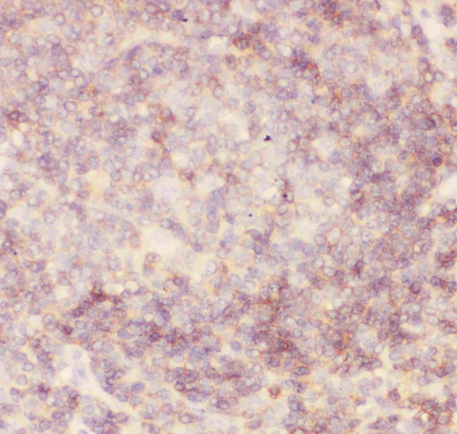 CD45 Antibody in Immunohistochemistry (Paraffin) (IHC (P))