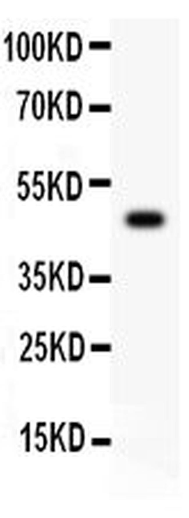 CD45 Antibody in Western Blot (WB)