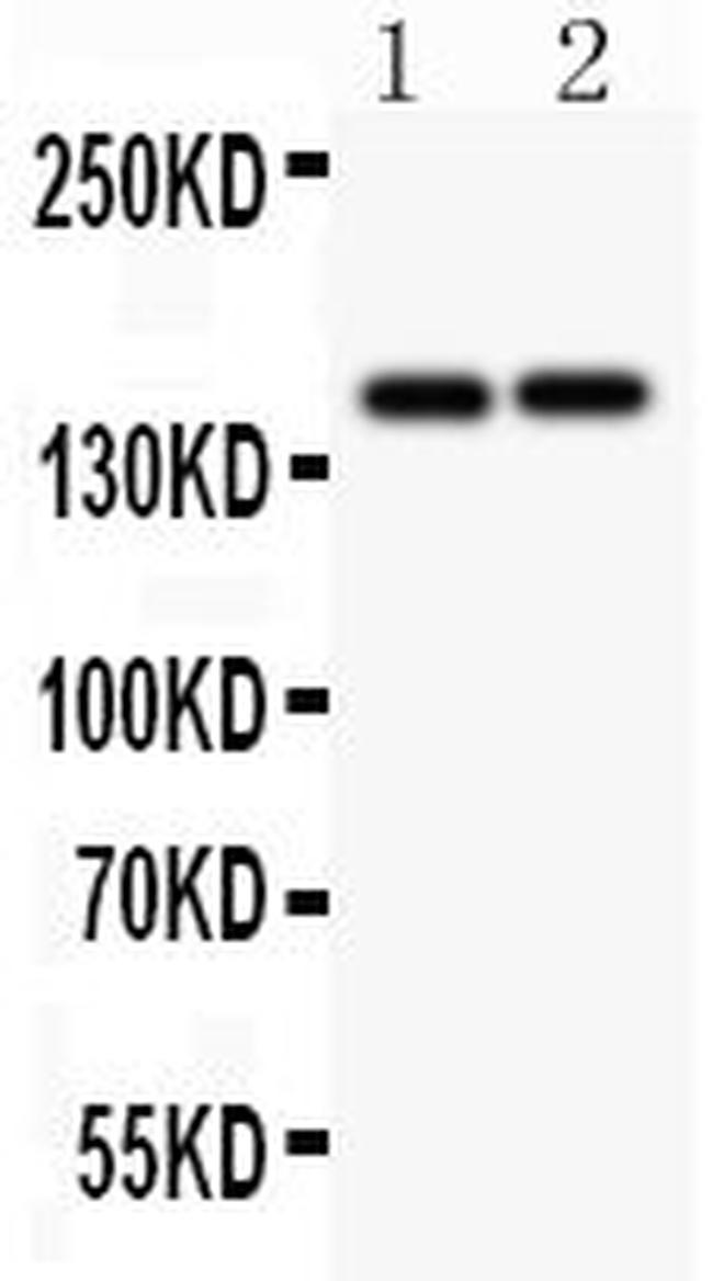 CD45 Antibody in Western Blot (WB)