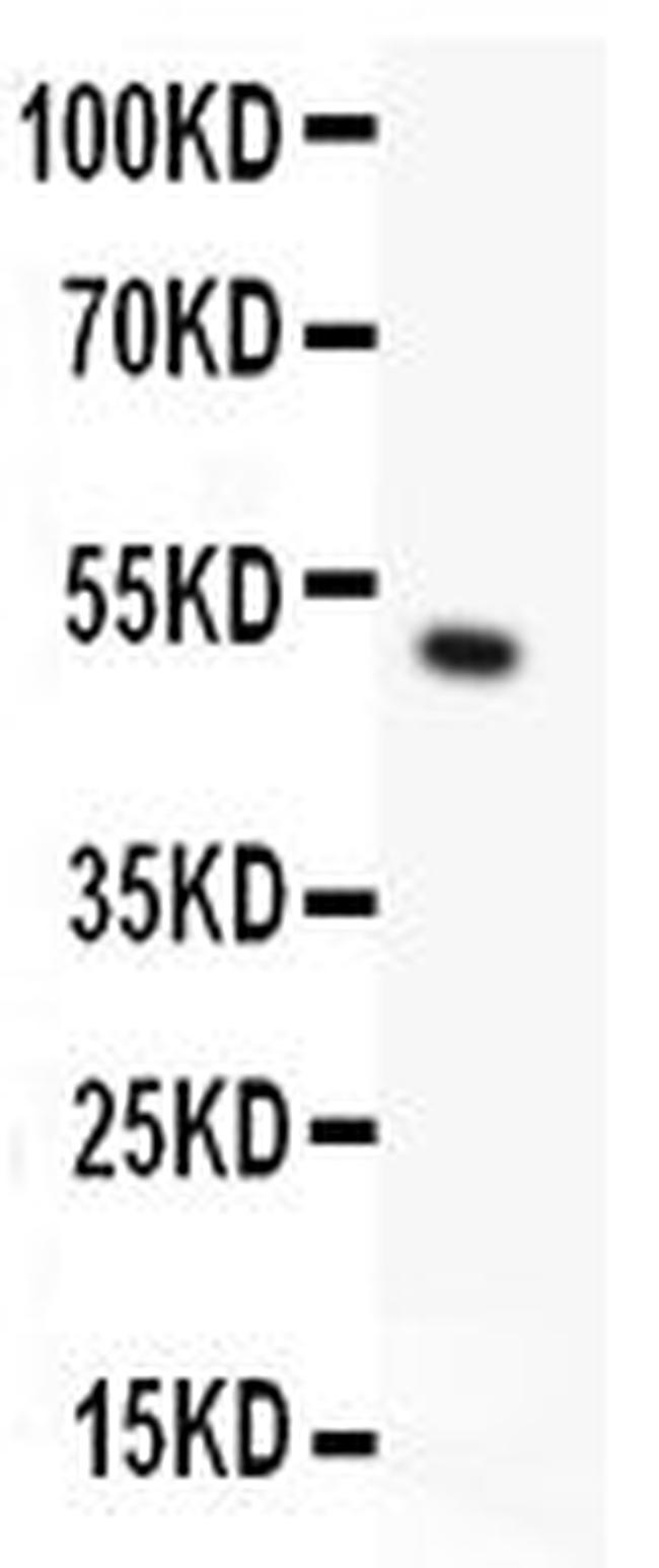 TRPC5 Antibody in Western Blot (WB)