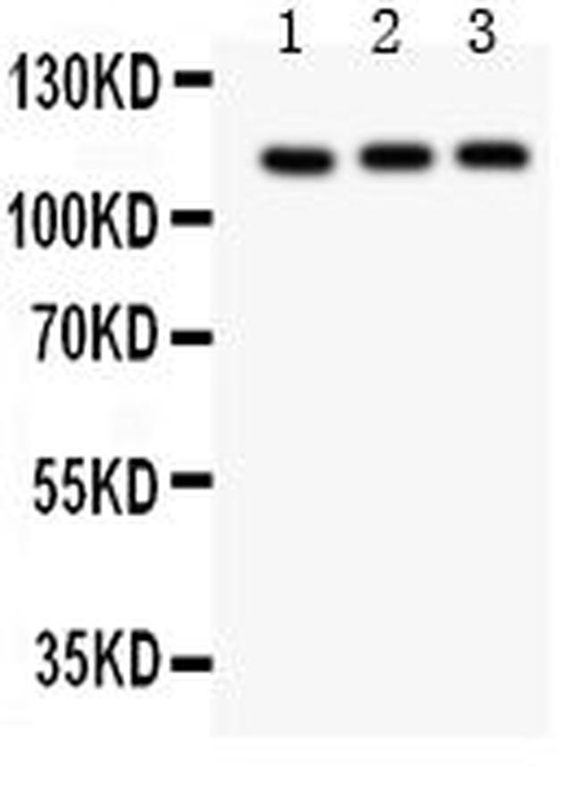 TRPC5 Antibody in Western Blot (WB)