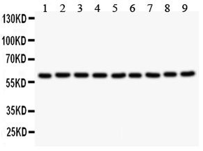 SMAD4 Antibody in Western Blot (WB)