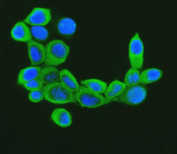 Cofilin Antibody in Immunocytochemistry (ICC/IF)