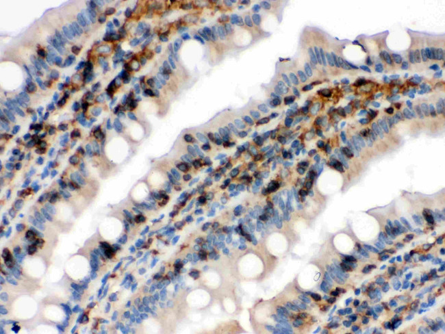 Cofilin Antibody in Immunohistochemistry (Paraffin) (IHC (P))