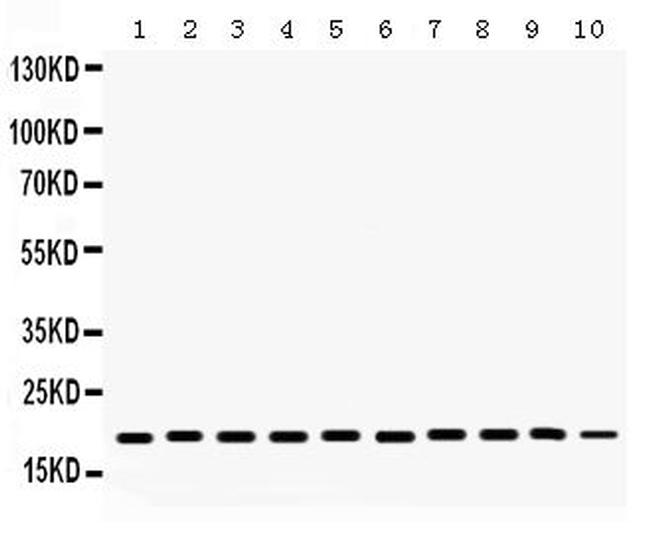 Cofilin Antibody in Western Blot (WB)