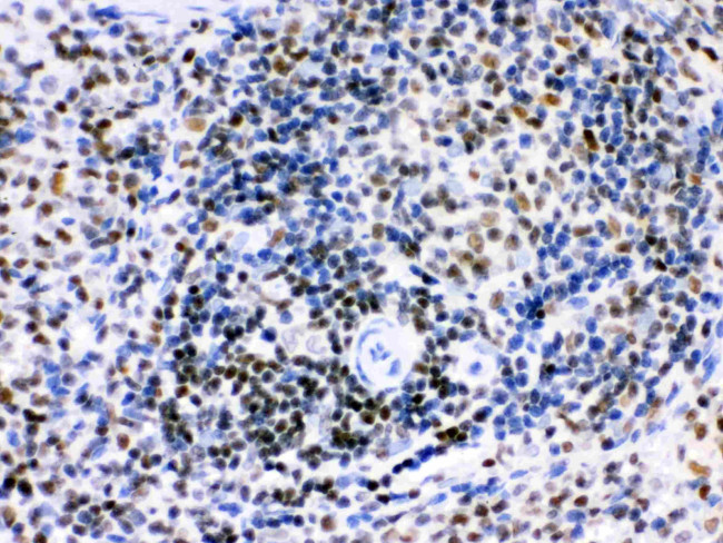 IKAROS Antibody in Immunohistochemistry (Paraffin) (IHC (P))