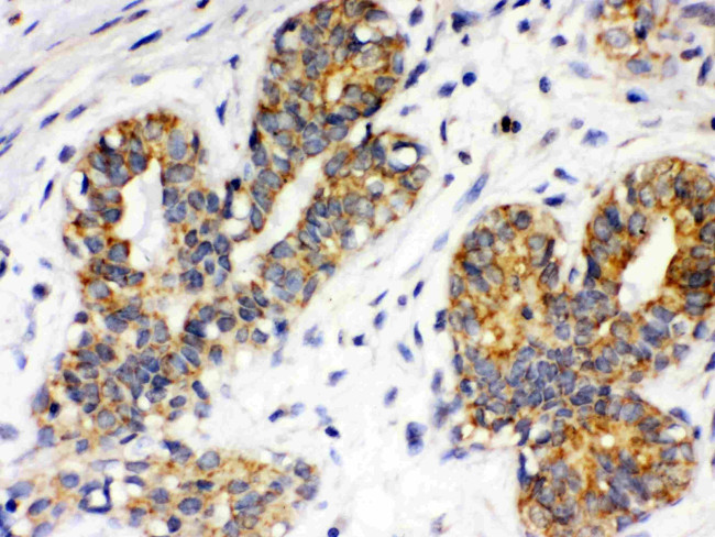 ITGA4 Antibody in Immunohistochemistry (Paraffin) (IHC (P))