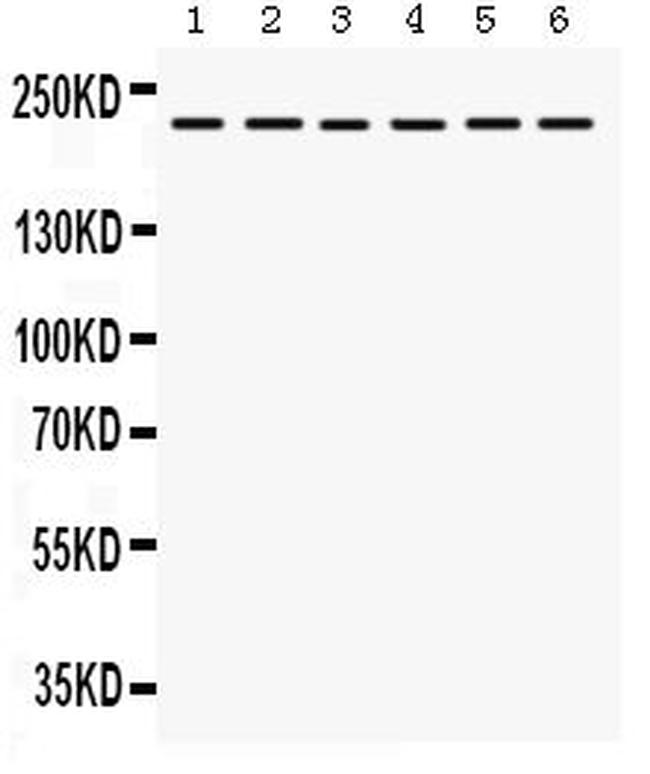 ITGA4 Antibody in Western Blot (WB)