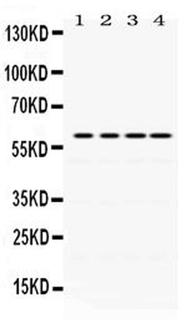 Cdc25C Antibody in Western Blot (WB)