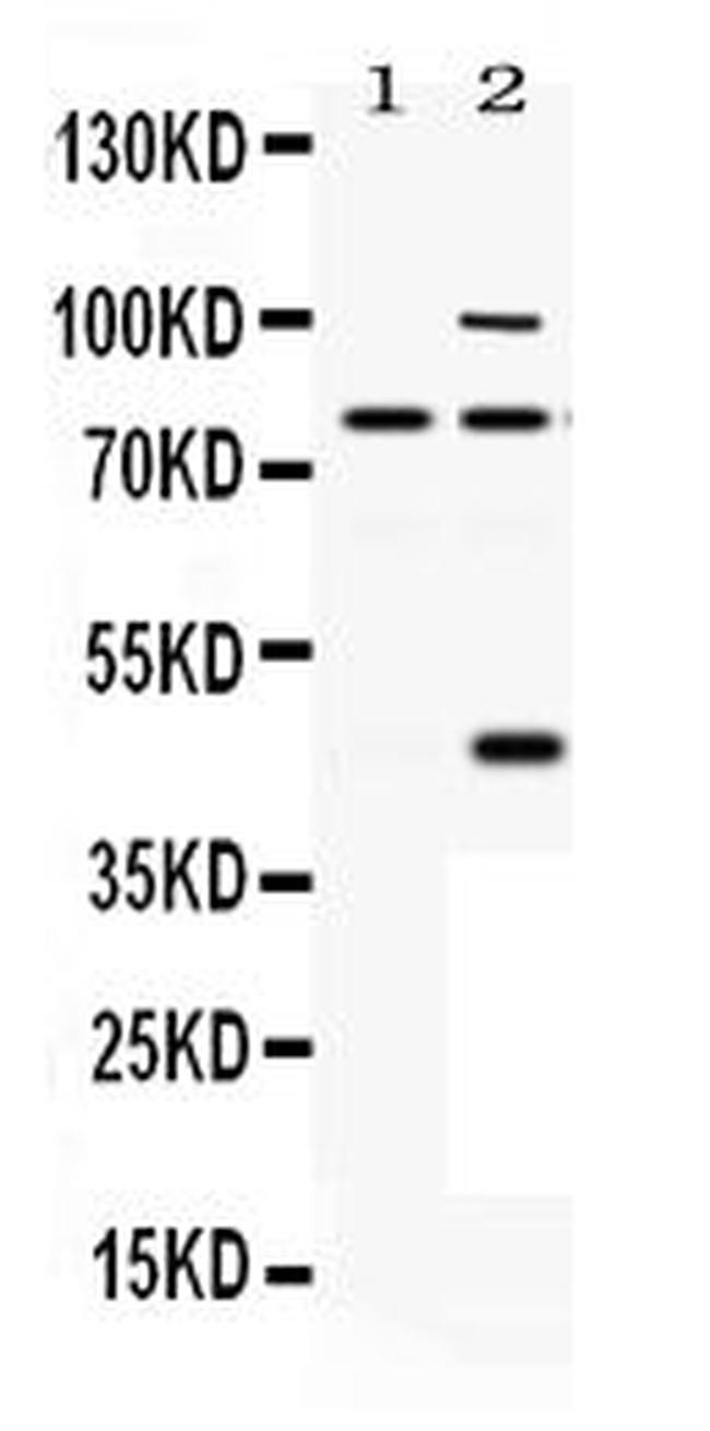 PCSK6 Antibody in Western Blot (WB)