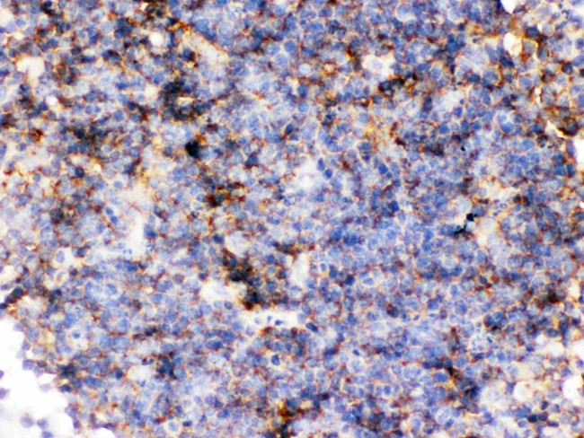 CD14 Antibody in Immunohistochemistry (Paraffin) (IHC (P))