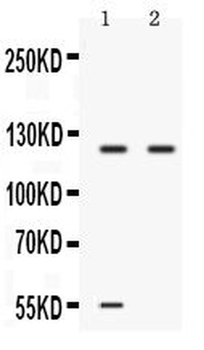 Ceruloplasmin Antibody in Western Blot (WB)