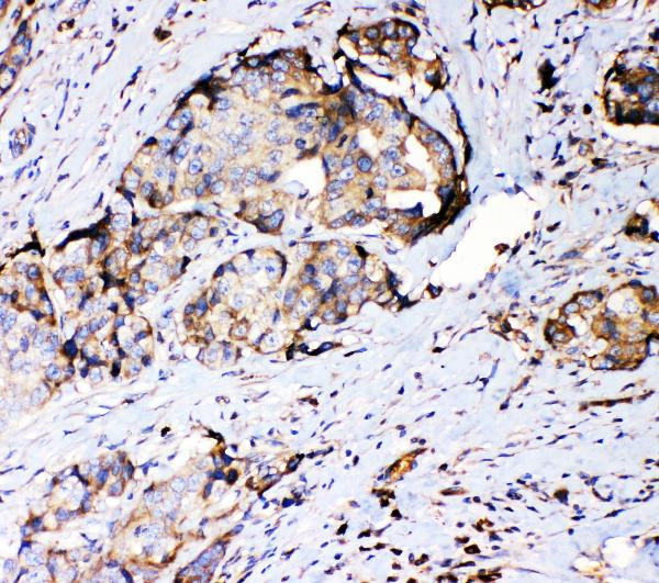 RPSA Antibody in Immunohistochemistry (Paraffin) (IHC (P))