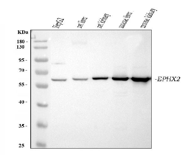 EPHX2 Antibody in Western Blot (WB)