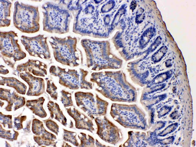 NAA15 Antibody in Immunohistochemistry (Paraffin) (IHC (P))