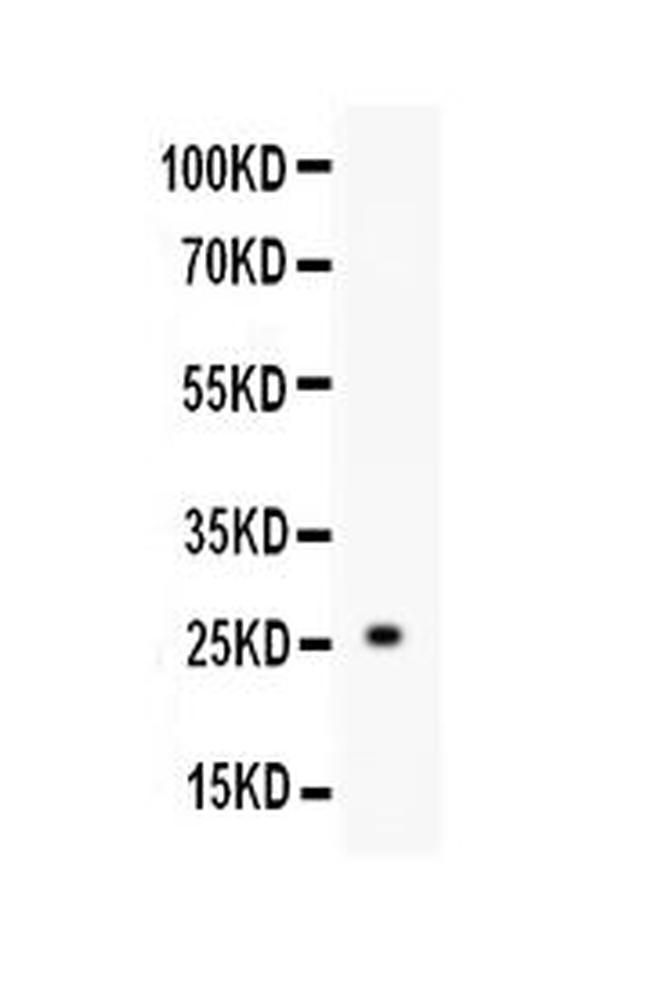 TREM1 Antibody in Western Blot (WB)