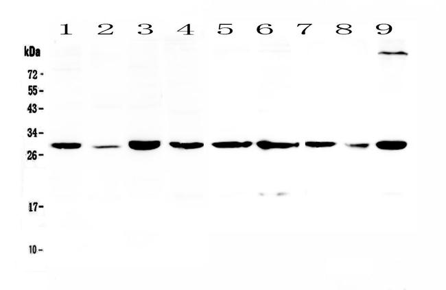 14-3-3 sigma Antibody in Western Blot (WB)