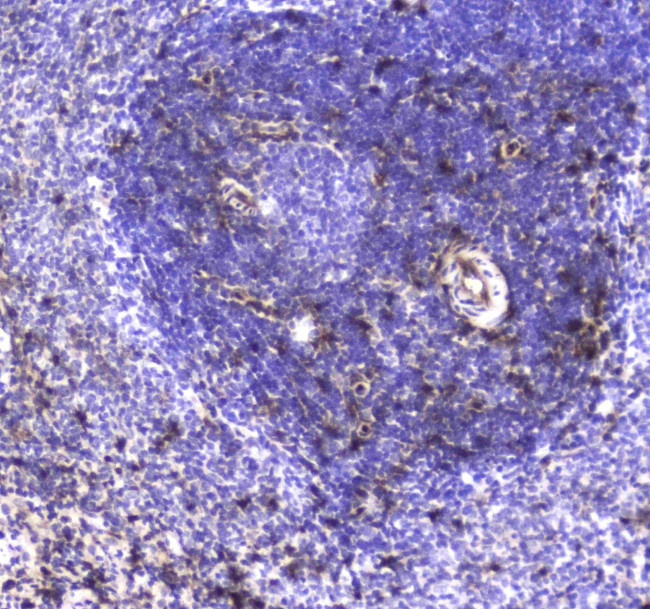 S100A10 Antibody in Immunohistochemistry (Paraffin) (IHC (P))