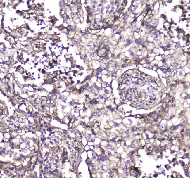 S100A10 Antibody in Immunohistochemistry (Paraffin) (IHC (P))