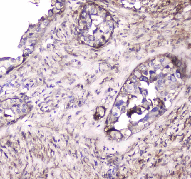 S100A10 Antibody in Immunohistochemistry (Paraffin) (IHC (P))