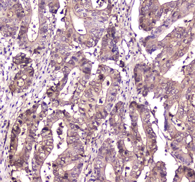 S100A10 Antibody in Immunohistochemistry (Paraffin) (IHC (P))