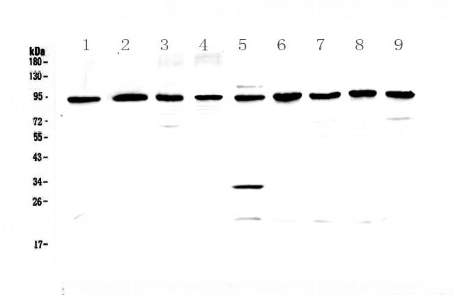 GNS Antibody in Western Blot (WB)