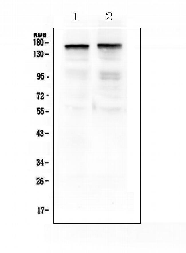 Thrombospondin 2 Antibody in Western Blot (WB)