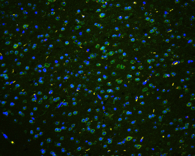 TPR Antibody in Immunohistochemistry (Paraffin) (IHC (P))