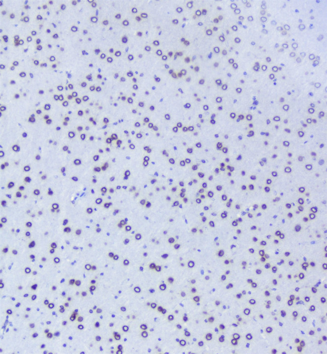 TPR Antibody in Immunohistochemistry (Paraffin) (IHC (P))