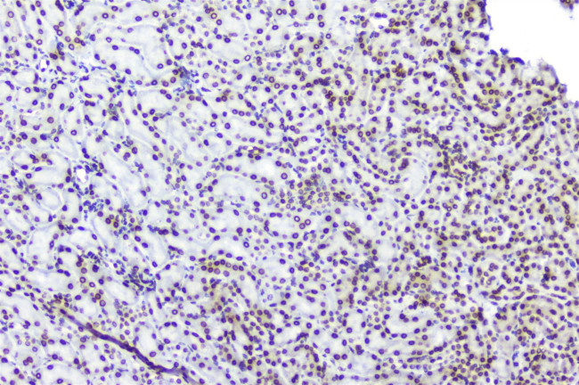 TPR Antibody in Immunohistochemistry (Paraffin) (IHC (P))