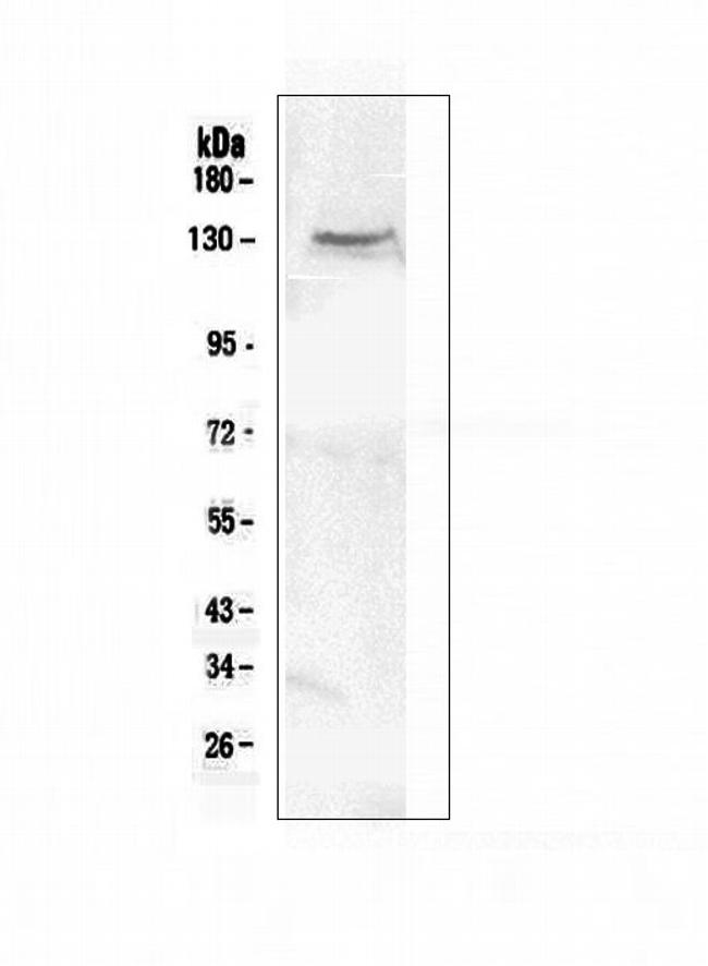 CACNA2D2 Antibody in Western Blot (WB)