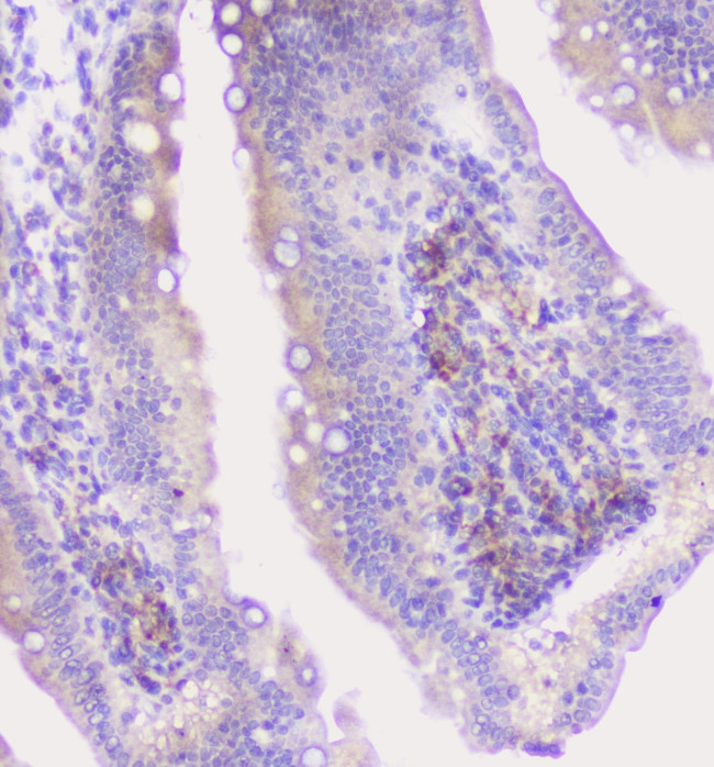 Properdin Antibody in Immunohistochemistry (Paraffin) (IHC (P))